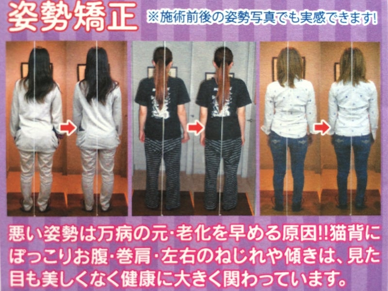 カイロ整体言い成り効くゾウの画像